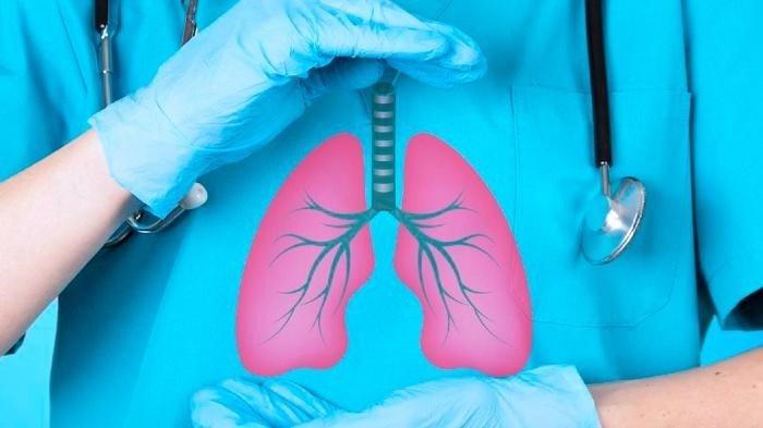 Ahli Kesehatan: Indonesia Perlu Belajar soal Harga Obat Murah dan Pengendalian TBC dari India