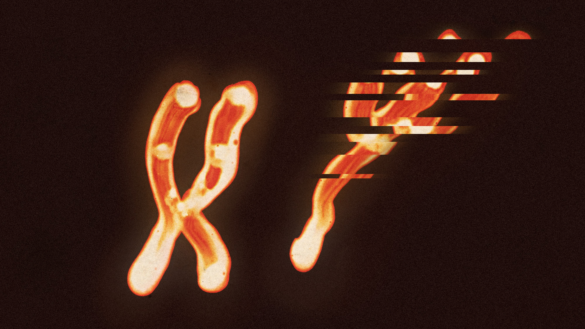 Is Your Y Chromosome Aging You? How Degradation Impacts Men's Health