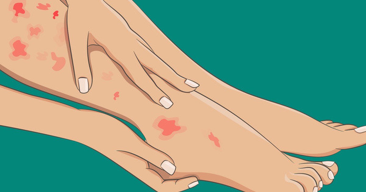 Waspada! Kaki Mati Rasa Bukan Sekadar Kesemutan: Ini 7 Penyebab Potensial dan Cara Mengatasinya