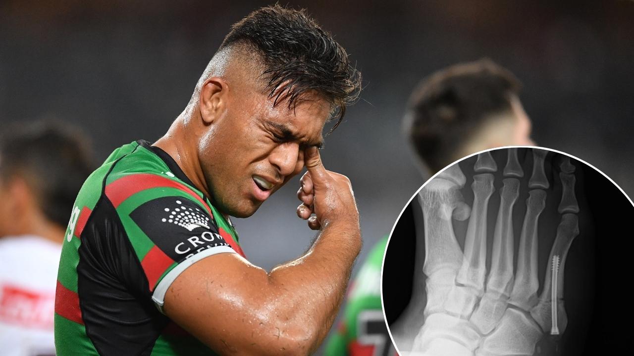 Tevita Tatola's Incredible Recovery: From Injury Hell to Walking Again