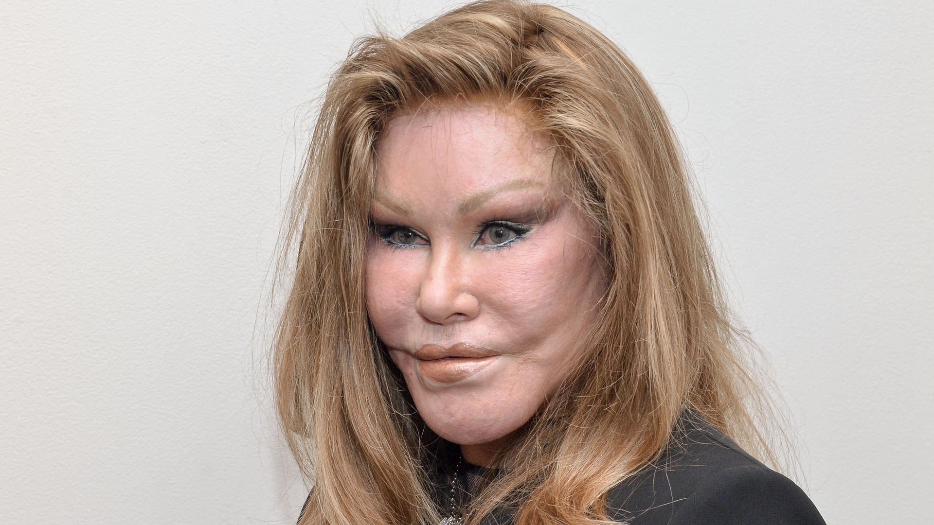 Jocelyn Wildenstein: Schockierender Tod und verpasste Verhaftung