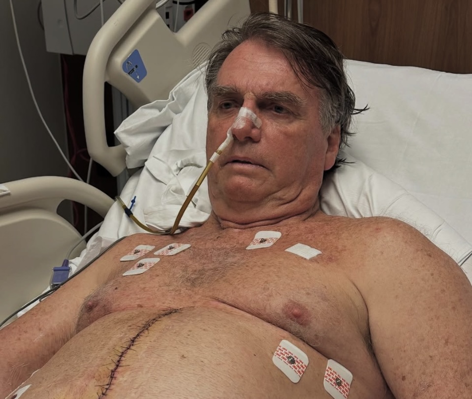 Jair Bolsonaro Anuncia Fase de Recuperação: Saiba Mais Sobre o Estado de Saúde do Ex-Presidente