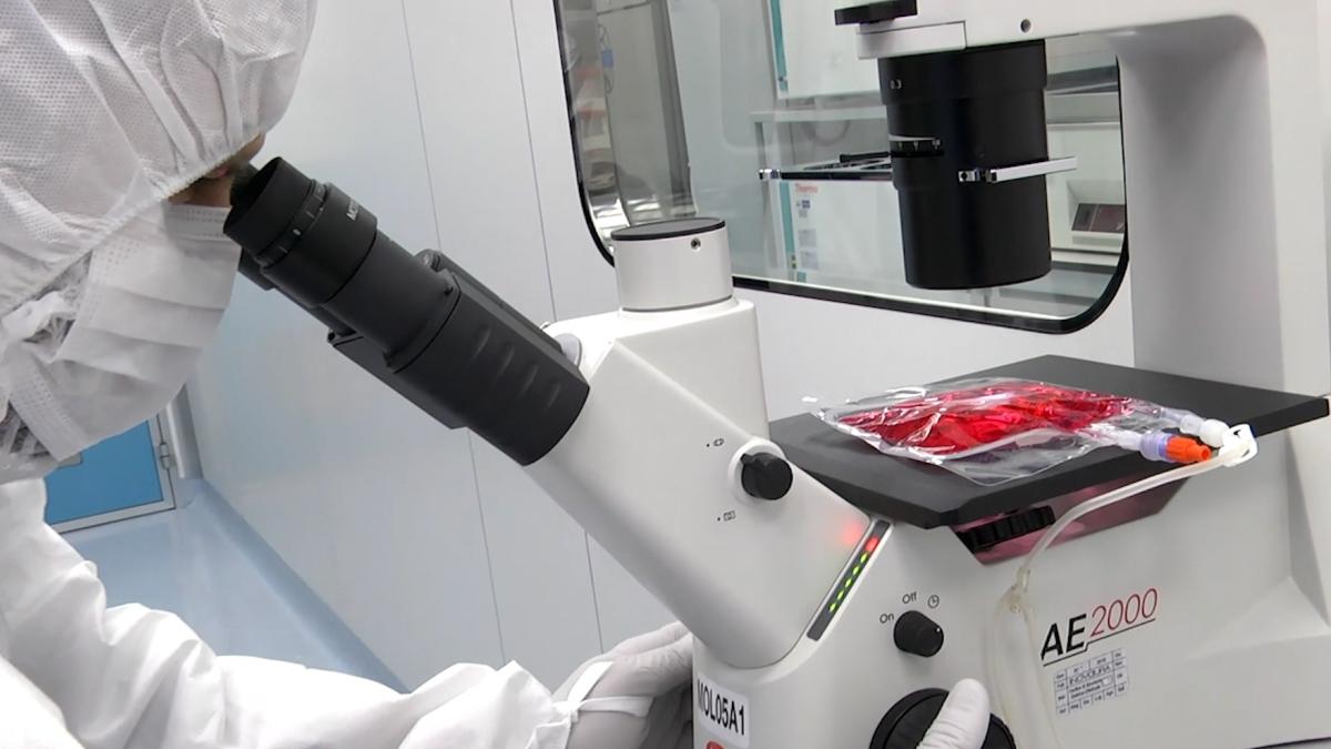 Prima paziente adulta con malattia reumatologica trattata con terapia Car-T in Italia