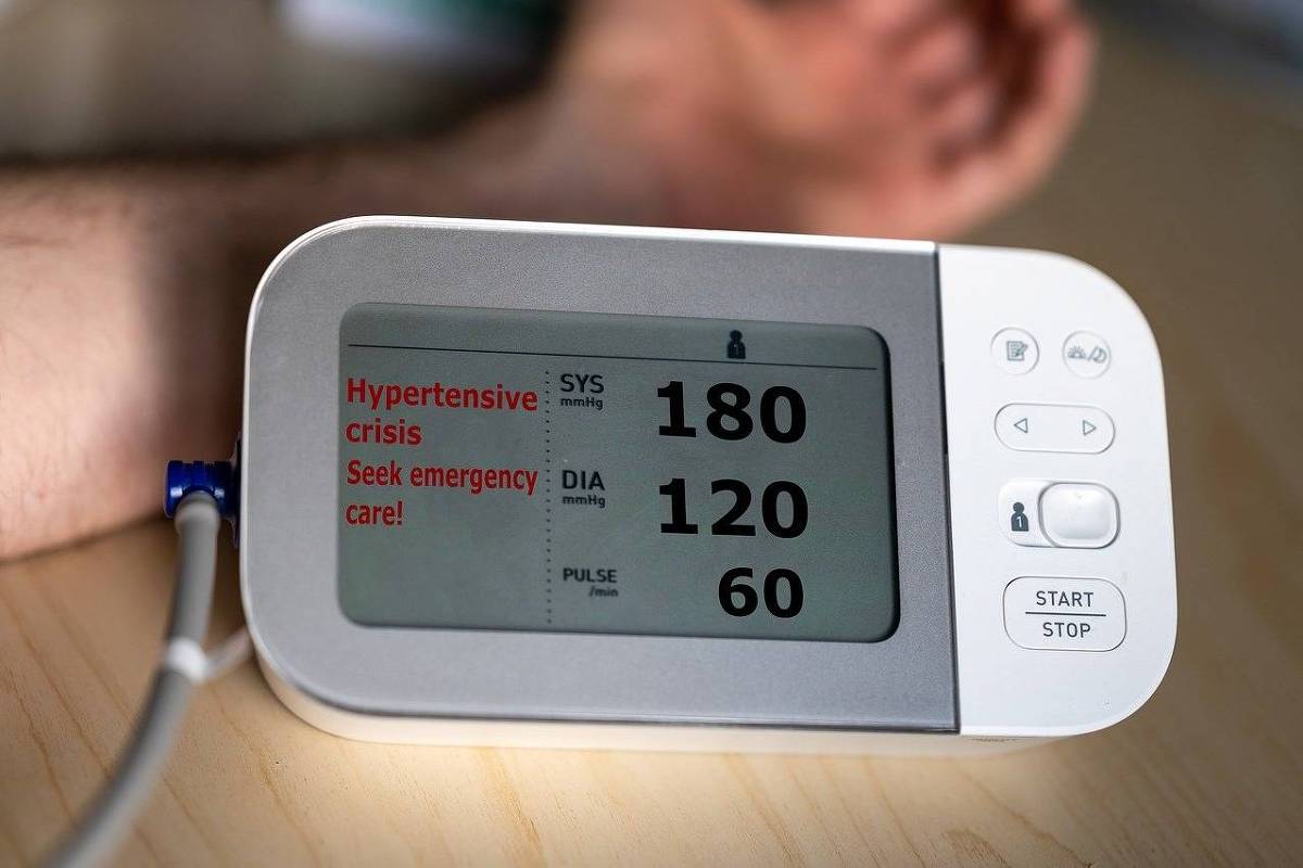 AVC no Brasil: Falhas na Prevenção e Atendimento Urgente Aumentam o Risco de Morte