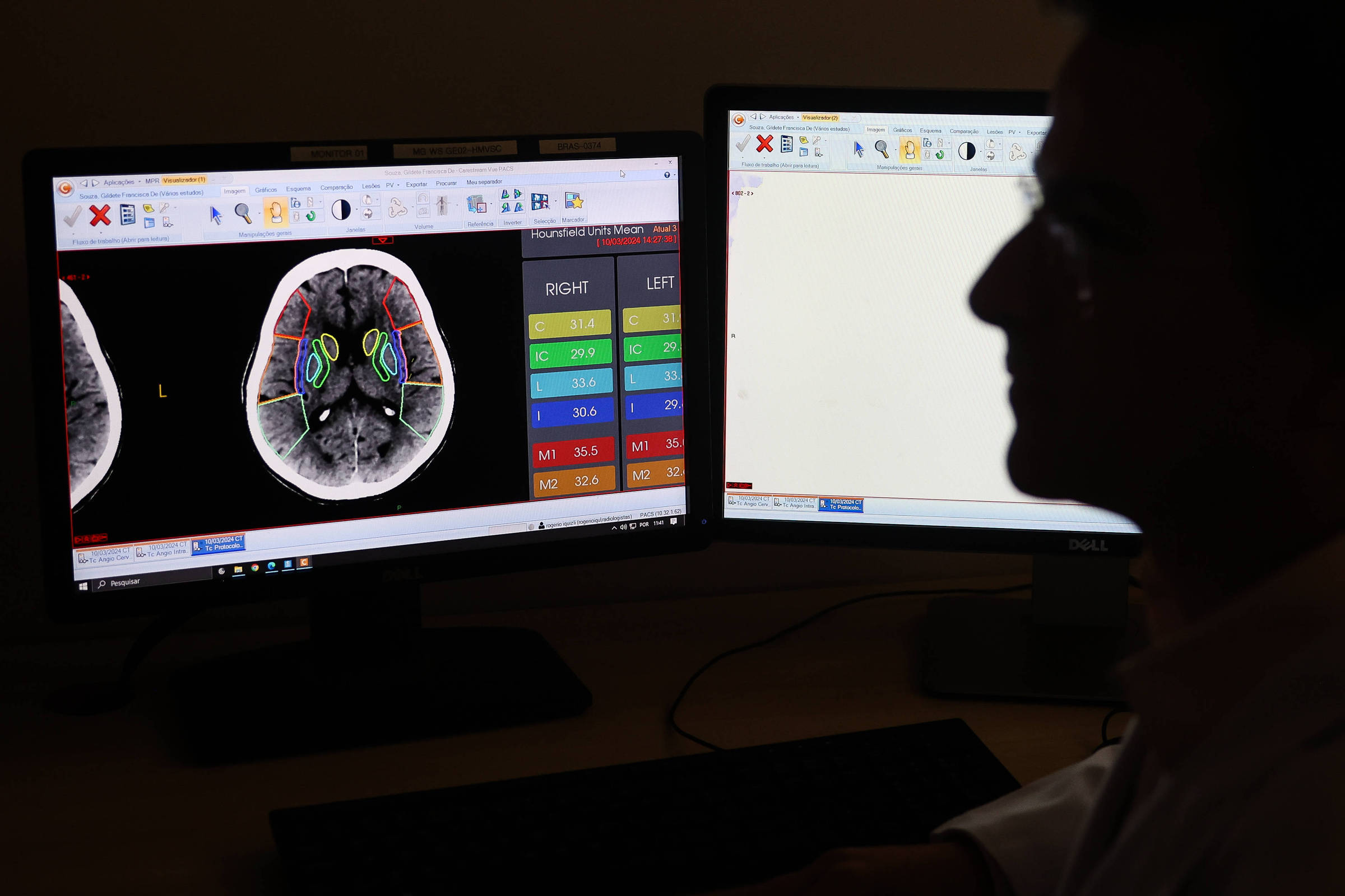 Inteligência Artificial no Hospital: Reduzindo Espera e Agilizando Atendimentos, Mas Levanta Questões Cruciais sobre Privacidade e Ética Médica