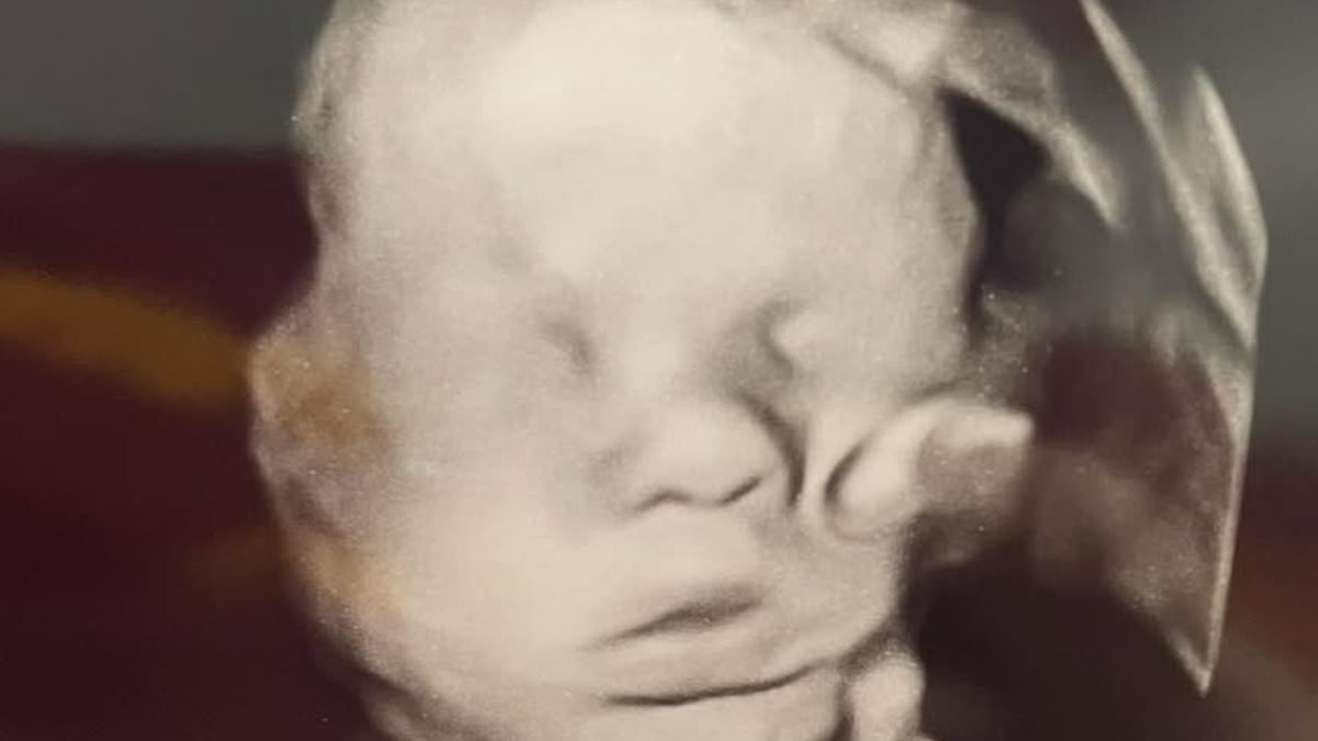 Kentucky Mom's Ultrasound Shows 'Hand of God' After Prayer, Sparks Miraculous Debate
