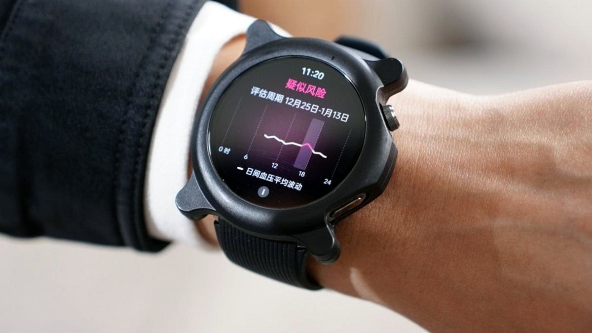 Oppo'nun Yeni Akıllı Saati: Tansiyon Ölçme Özelliğiyle Devrimsel Bir Adım