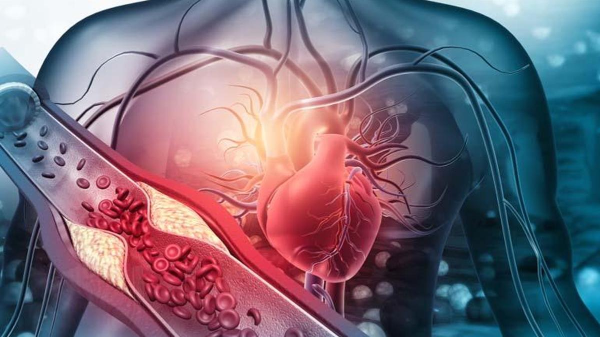 Anjiyo Bağımlılığı Alarmı! Uzmanlar Uyardı: Gereksiz Anjiyo Hayat Tehlikesi Oluşturabilir