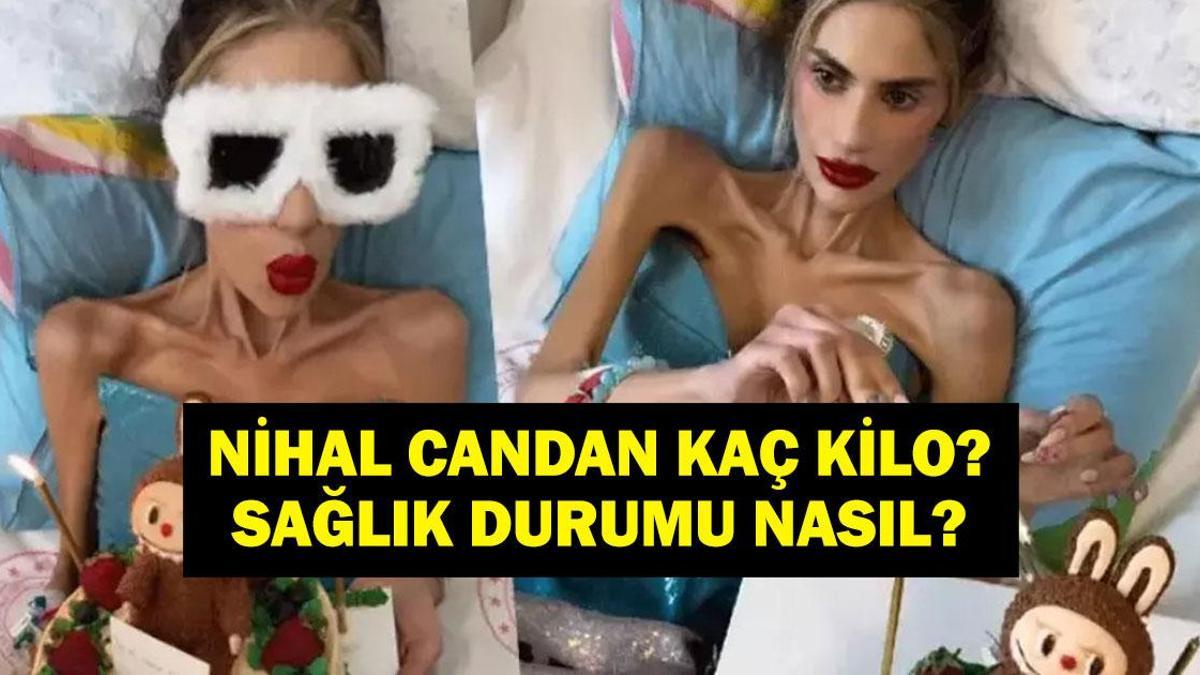 Nihal Candan'ın Sağlık Durumu Alarm Veriyor: Yoğun Bakıma Girdi, Kilo Kaybı ve Anoreksiya Mücadelesi! Detaylar