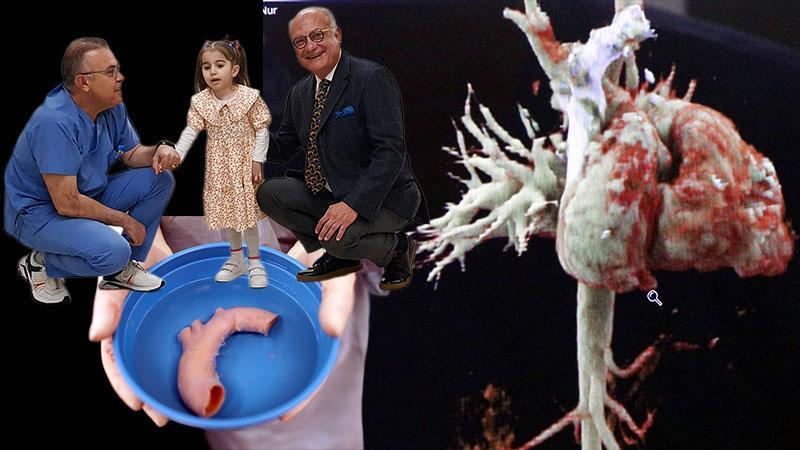 Türkiye'de Tıp Mucizesi: Kalbi 'Yatay' Doğmuş Kız, Ameliyatla Hayata Tutundu! Dünyada Bir İkinci!