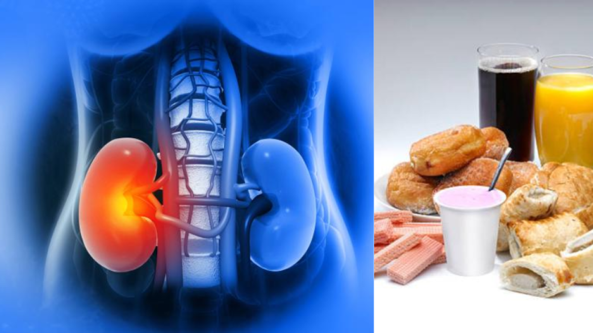 Siete alimentos que en exceso pueden hacer daño a sus riñones, según expertos: consuma con moderación y cuide su salud