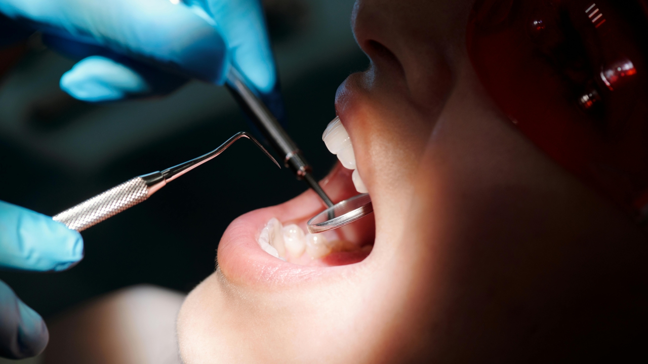 Sarthe : un dentiste formé grâce à la bourse du département choisit de travailler ailleurs