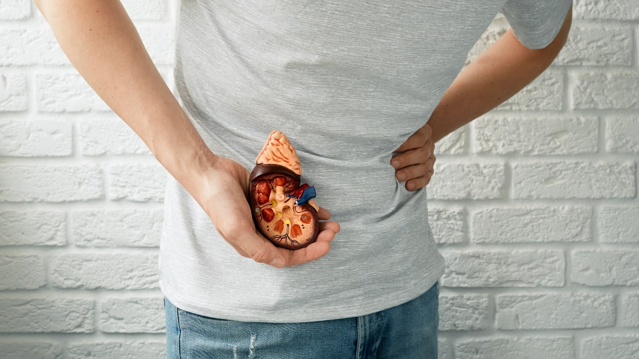Low Testosterone Linked to Higher Kidney Stone Risk in Filipino Men: What You Need to Know