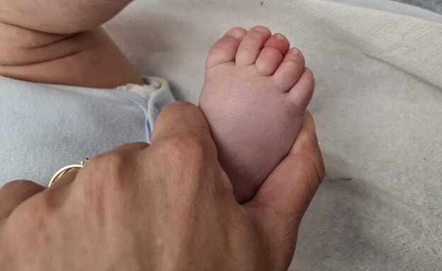 תינוק בן חודש וחצי ניצל מנמק: שערת ראש התהדקה סביב אצבעו