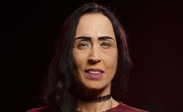 מאבק יומיומי: כך לקות ראייה מקשה על פרנסה בישראל בעידן המלחמה