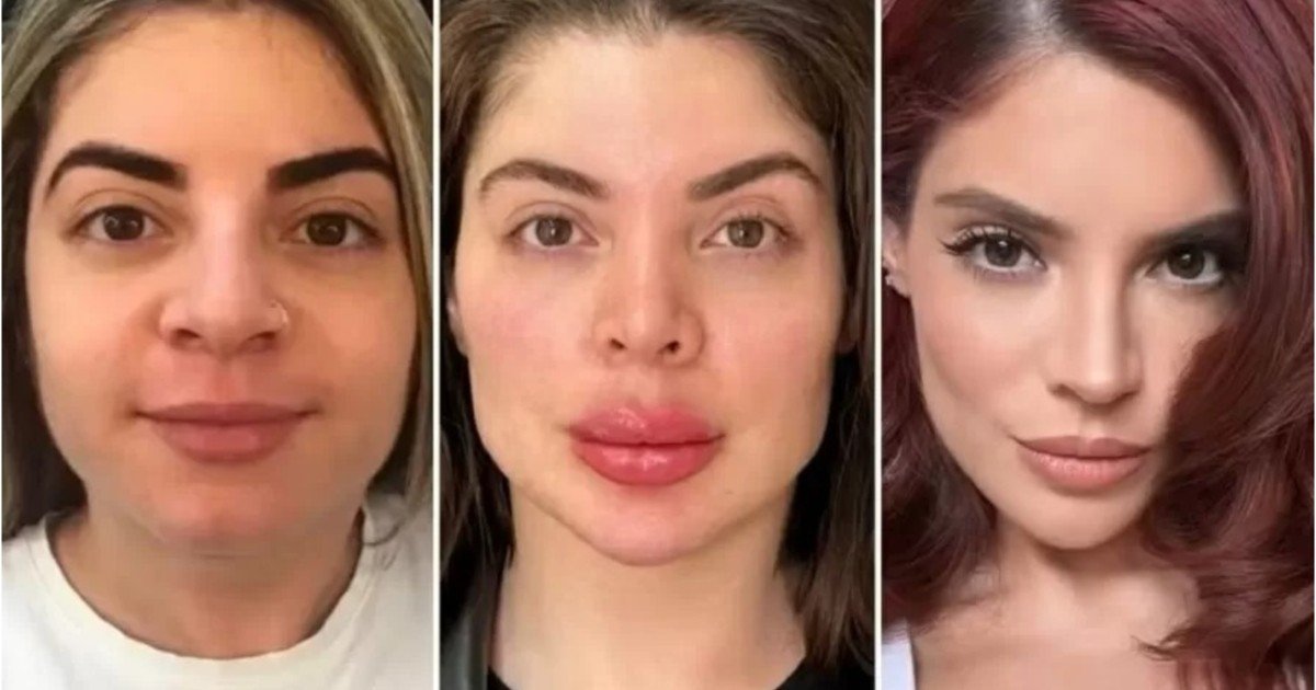 Celebridades se rendem à revolução da beleza natural; entenda