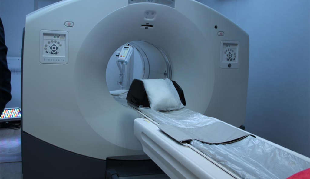 Révolution dans le Diagnostic du Cancer de la Prostate : Le Scan PET, un Espoir pour l'Avenir ?