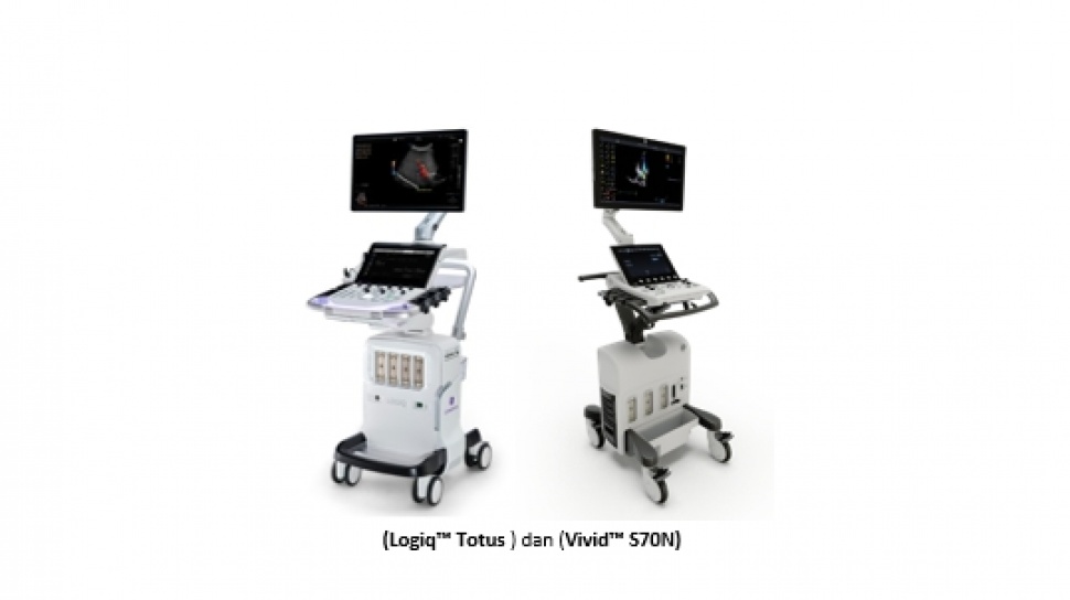 Peran Vital Teknologi AI dalam Ultrasound untuk Deteksi Dini dan Diagnostik Penyakit