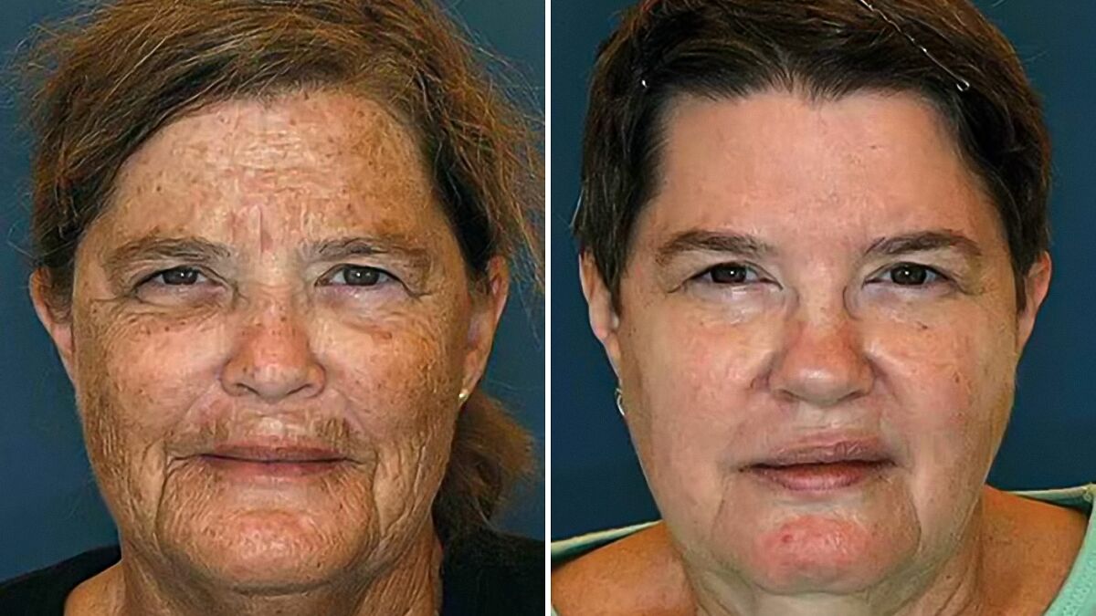 Twin Study Reveals Shocking Effects of Lifestyle Choices on Aging: You Won't Believe the Difference