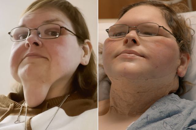 Tammy Slaton's Brave New Chapter: Skin Removal Surgery & Facing Fears After 500lb Weight Loss (Exclusive)