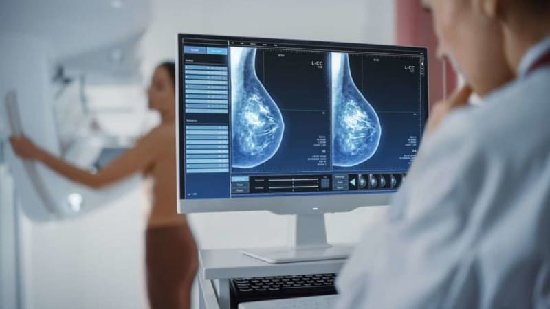 AI Breakthrough: New Technology Promises 30% Boost in Early Breast Cancer Detection