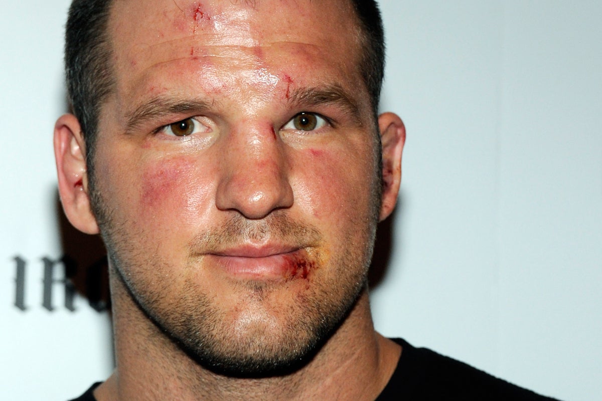 Miracle of Modern Tech: Deaf UFC Icon Matt Hamill Regains Hearing After 41 Years