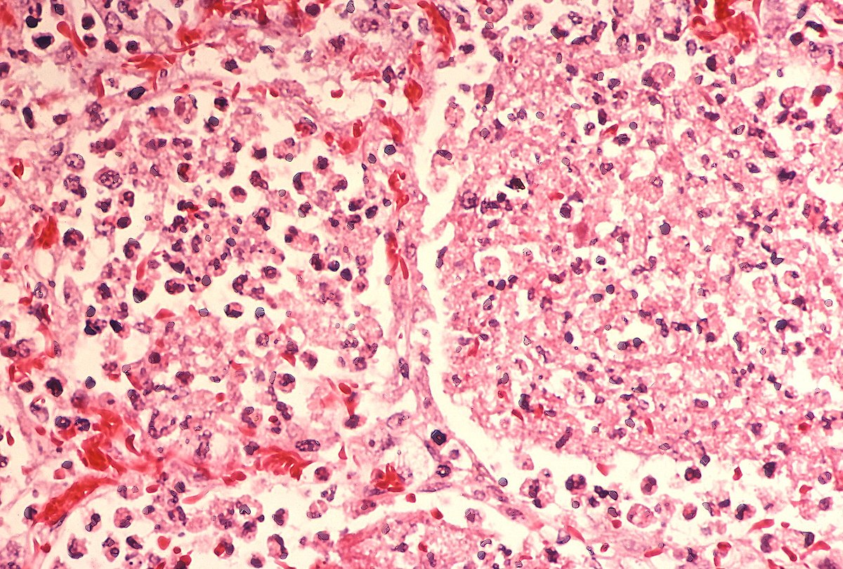 Prevenzione della Legionella: trattamento acque per la tua salute