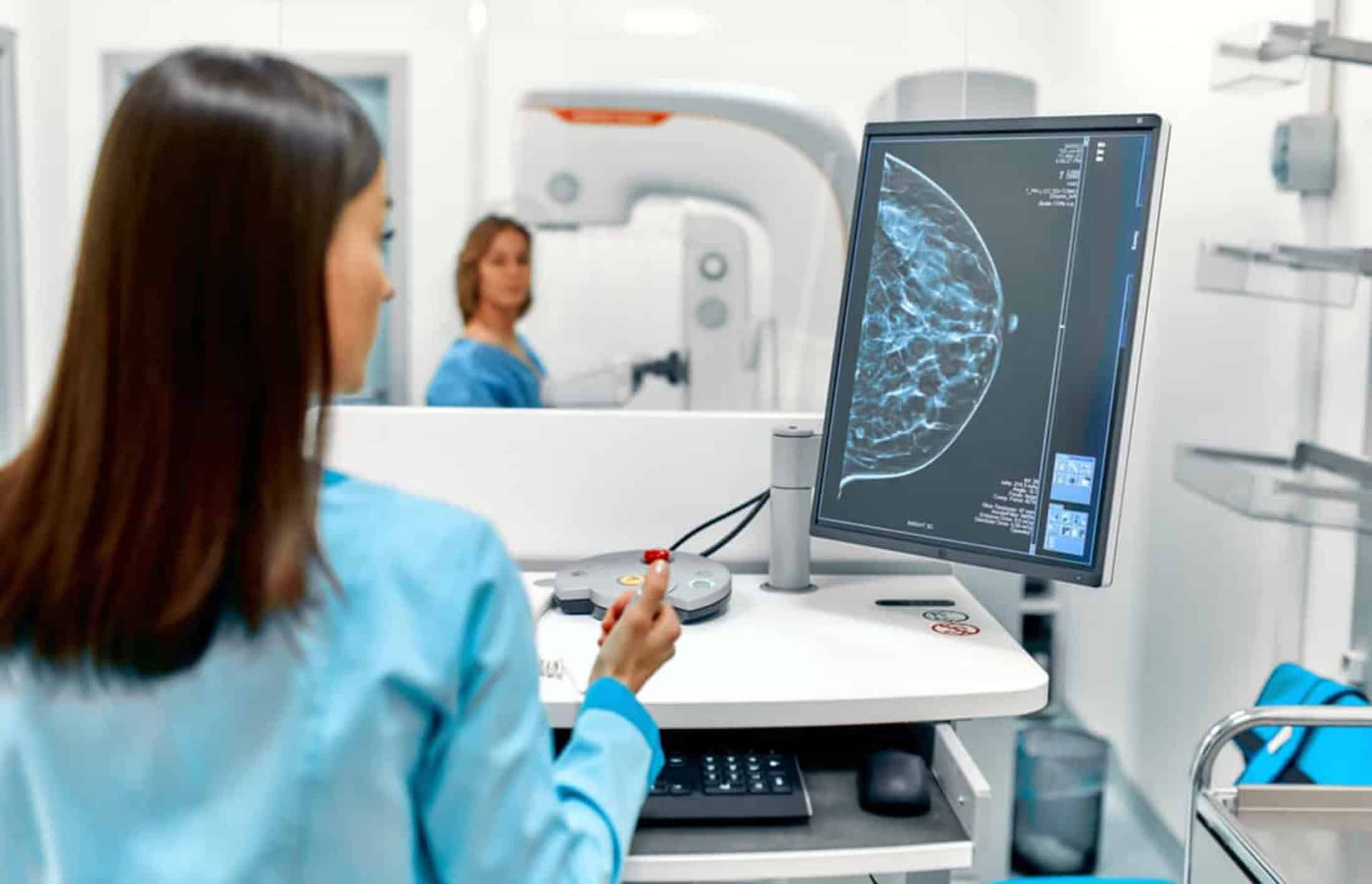 Tecnologia pode detectar retorno do câncer de mama com antecedência