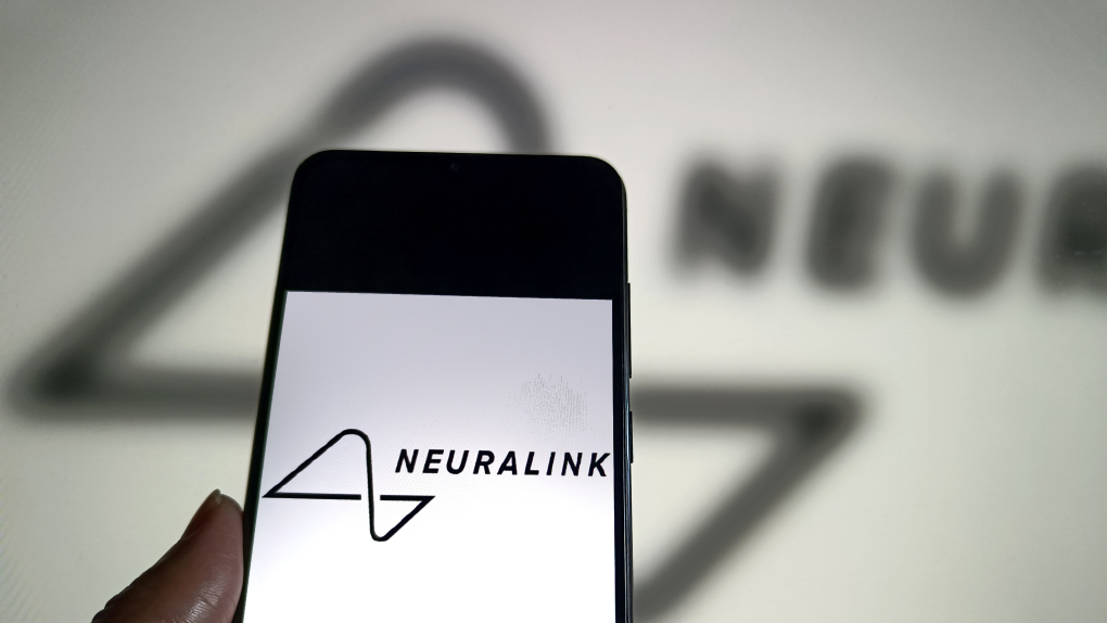 Илон Маск: Успешные испытания Neuralink - трем людям вживили мозговой имплант!