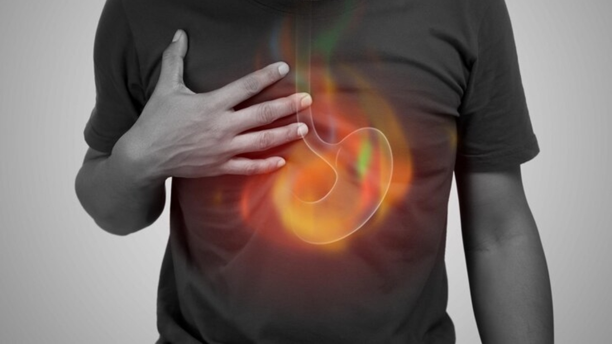Beat the Burn: Simple Lifestyle Changes for Acid Reflux & GERD Relief (Doctor-Approved!)