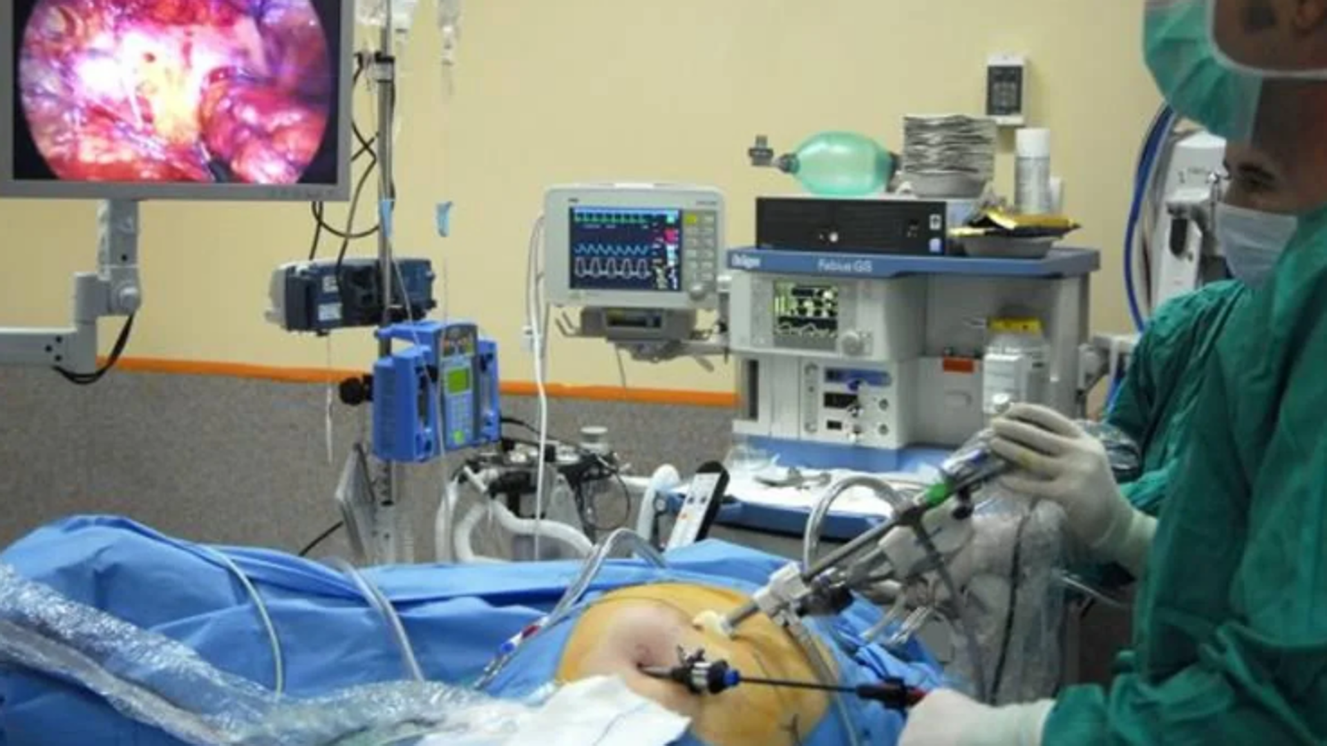 Dieta saludable, ejercicio físico y más cribados, claves contra el cáncer de colon