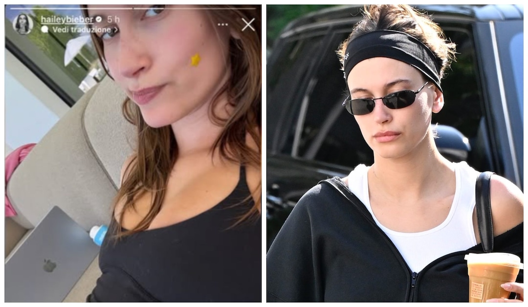 Hailey Bieber Apre il Cuore: La Lotta Silenziosa Contro le Cisti Ovariche e un Messaggio di Speranza