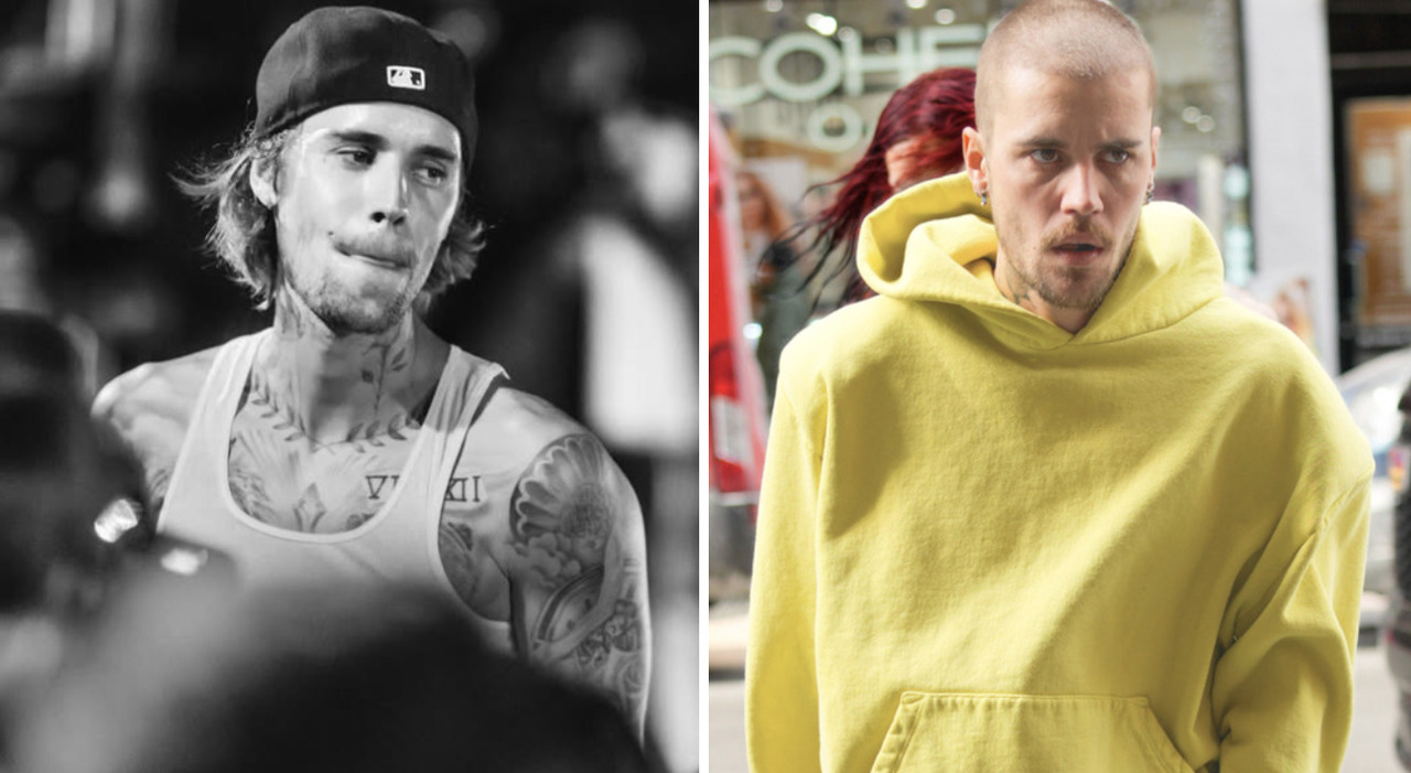 La salute di Justin Bieber preoccupa i fan: dimagrimento e sguardo perso, l'appello di Hailey