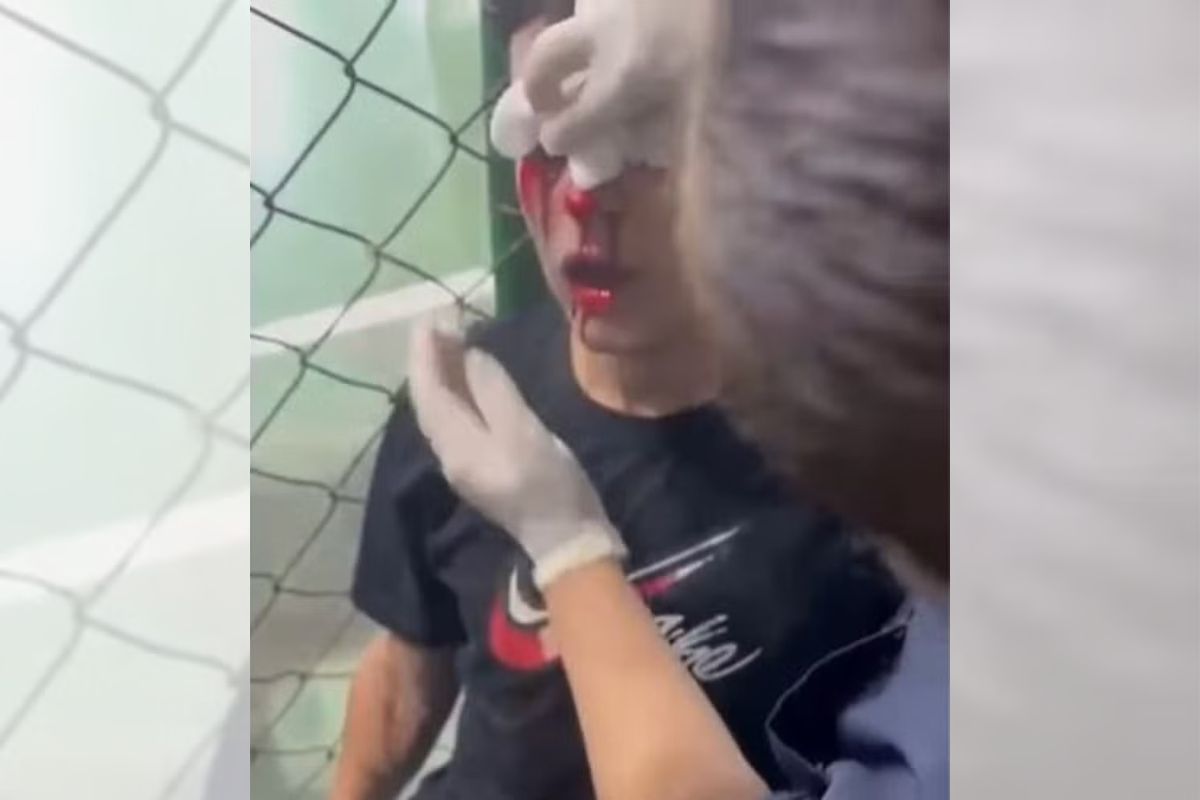 Jogador de Futsal Atingido por Bomba: Clube Divulga Estado de Saúde Atualizado