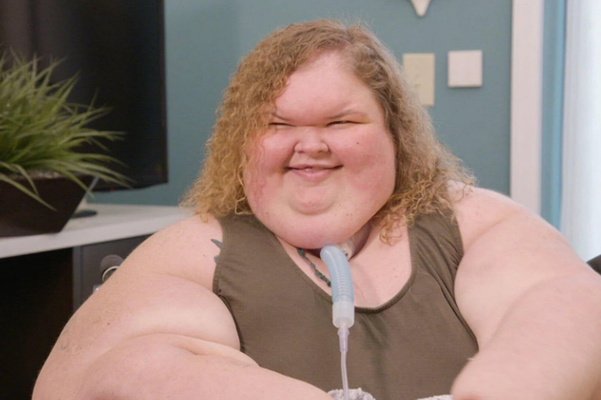Veja antes e depois de estrela de reality show que perdeu 226 kg