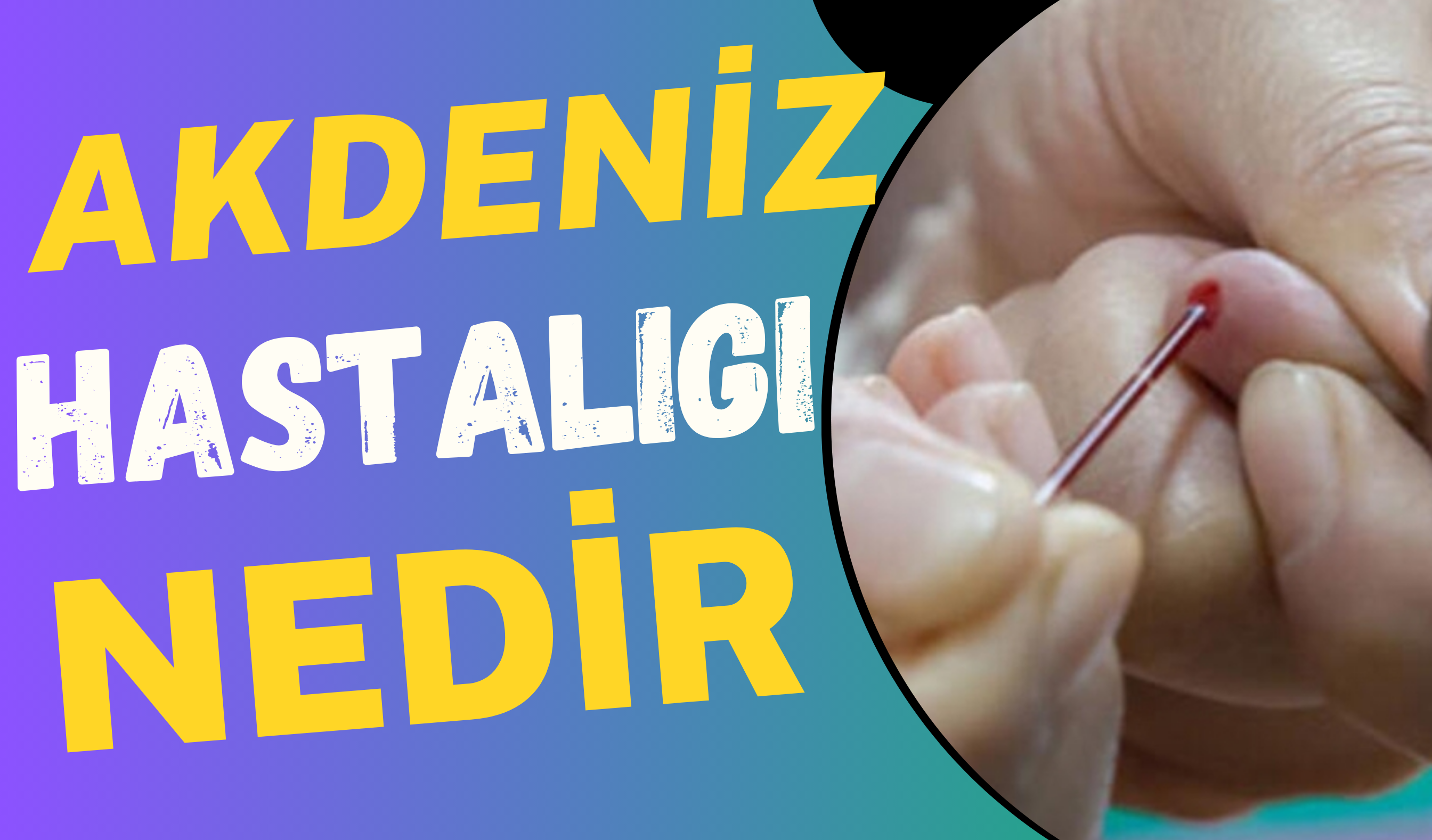 Akdeniz Hastalığı: Nedenleri, Belirtileri ve Tedavi Yöntemleri