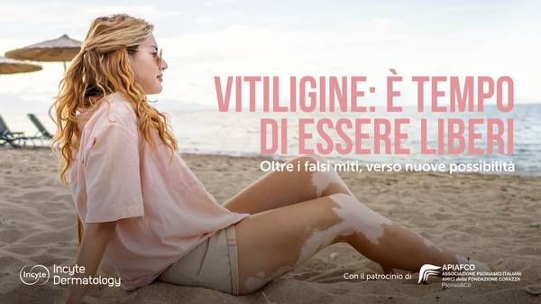 Vitiligine: Lancio della Campagna 'Oltre i Falsi Miti' per Informare e Supportare Chi Ne È Affetto