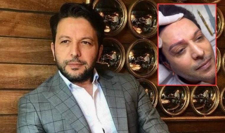 Nihat Doğan Göz Kapağı Estetiği Yaptırdı! Sosyal Medya Yorumları ve Yeni Hali