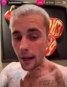 Justin Bieber'ın Şok Eden Yeni Hali!