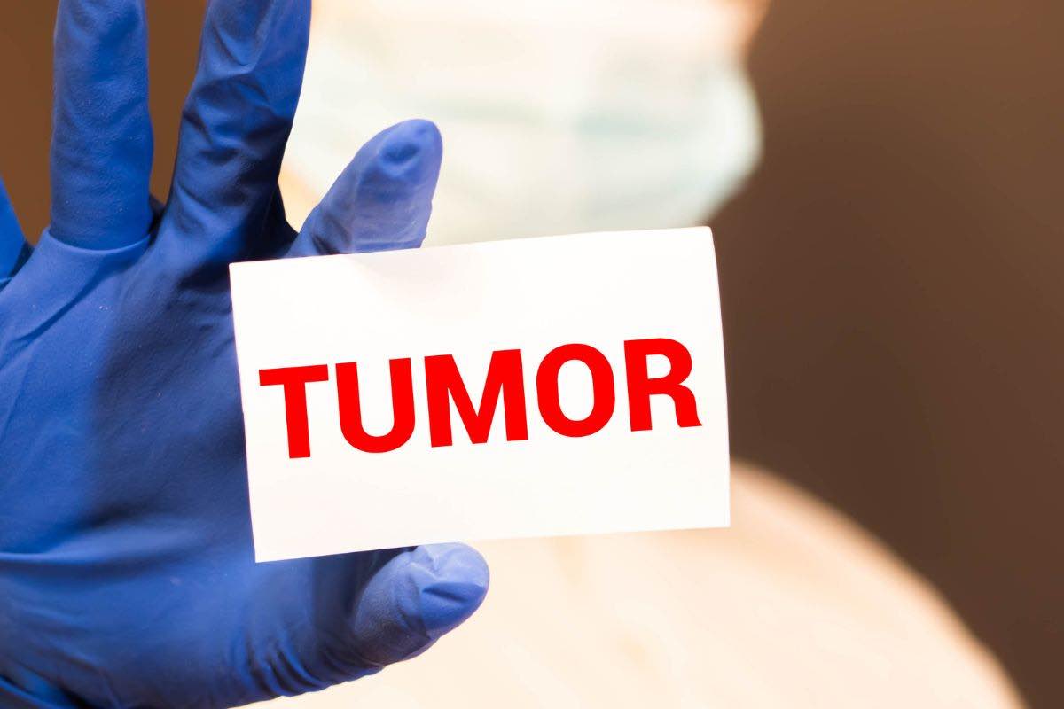 Tumore: cause, sintomi e stili di vita a rischio. Scopri i fattori che aumentano il pericolo