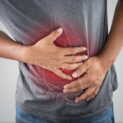 Frenare l'infiammazione intestinale