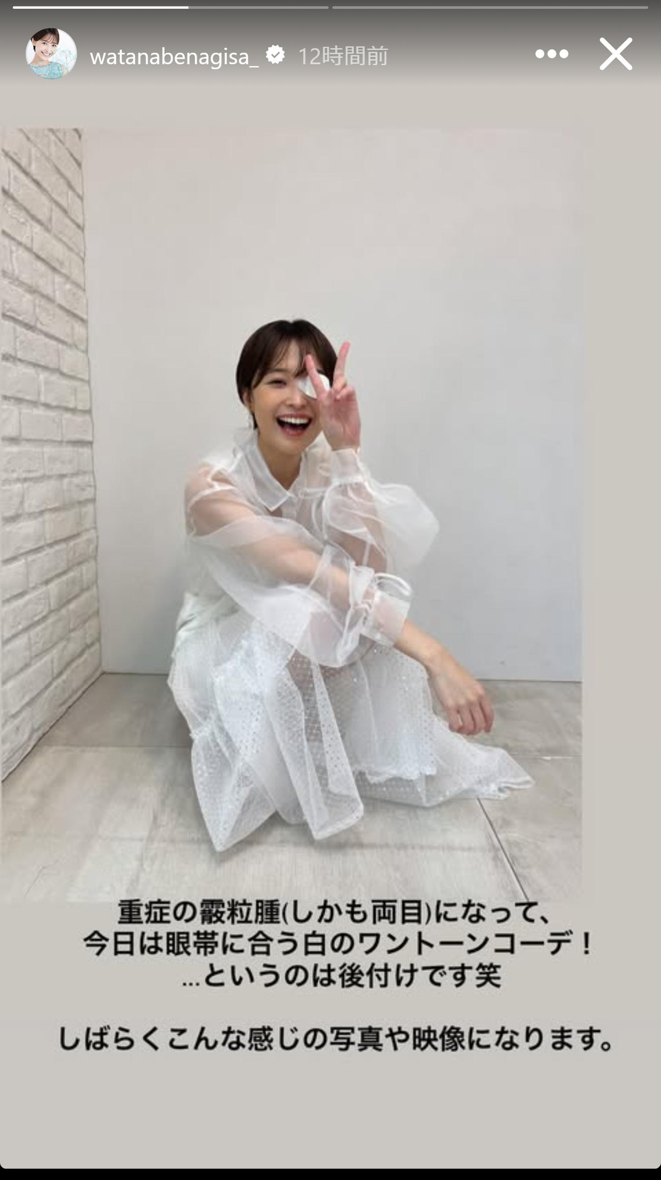 病気療養中の元フジテレビアナウンサー・渡辺渚さん、体調告白：体力低下と免疫力低下に苦しむ現状
