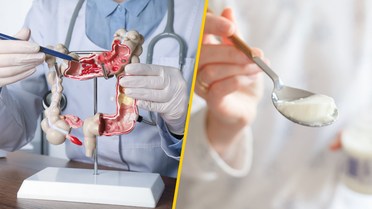 Jogurt a rak jelita grubego: Zaskakujące wyniki badań naukowych