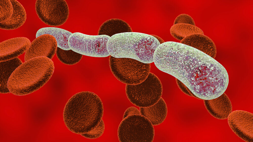 This Ohio health system tested an AI tool to predict sepsis. Here's how it went