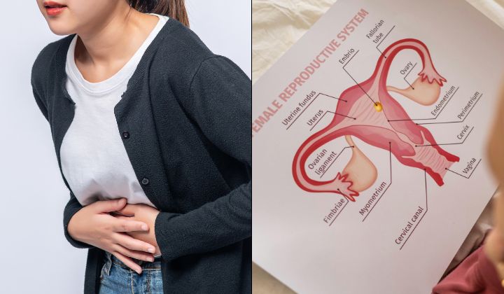 Amaran Kesihatan Wanita: Risiko Kanser Ovari Meningkat Selepas Menopaus – Kenali Tanda-Tanda Awal!